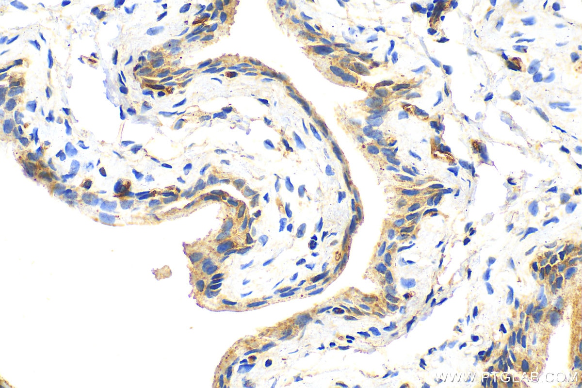 Immunohistochemistry (IHC) staining of mouse bladder tissue using UPK3A Polyclonal antibody (55229-1-AP)