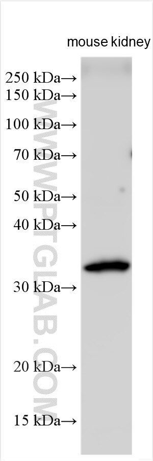 Western Blot (WB) analysis of various lysates using UPK3A Polyclonal antibody (55229-1-AP)