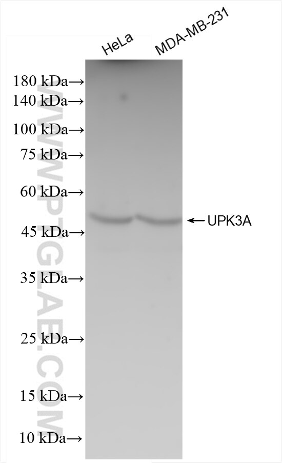 Western Blot (WB) analysis of various lysates using UPK3A Recombinant antibody (83499-3-RR)