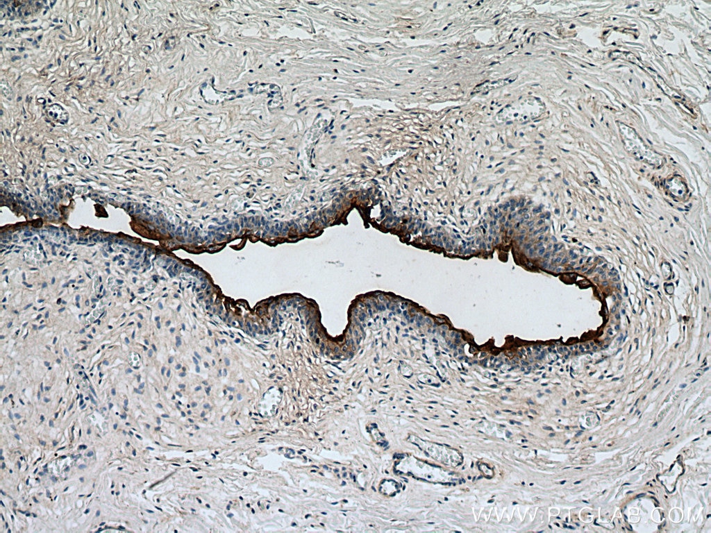 Immunohistochemistry (IHC) staining of human bladder tissue using UPK3B Polyclonal antibody (15709-1-AP)