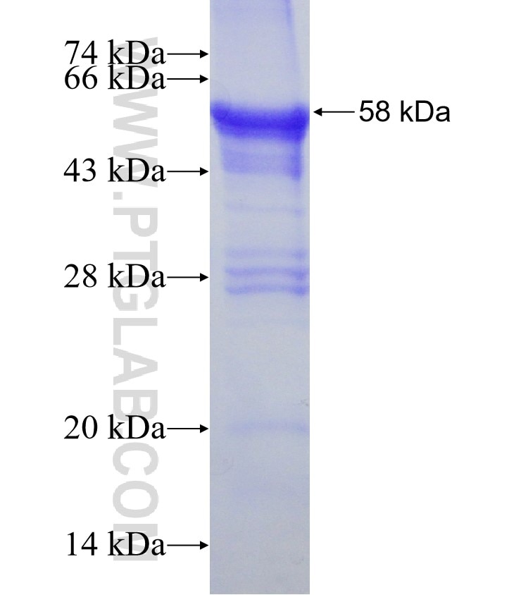 UPK3B fusion protein Ag8326 SDS-PAGE