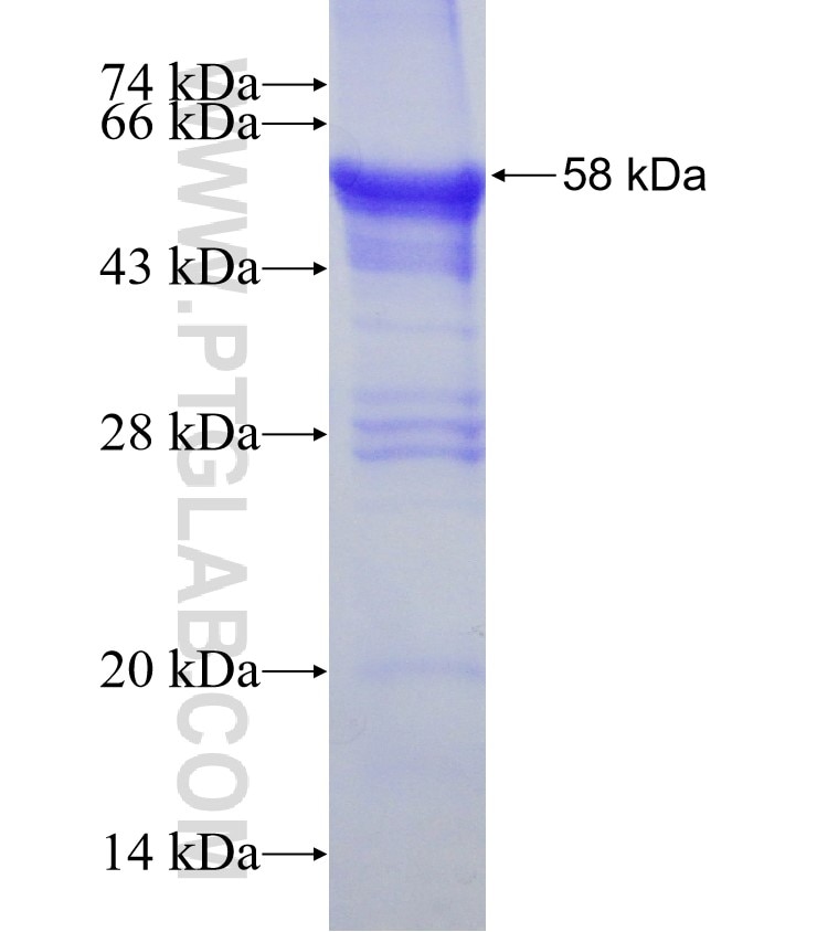 UPK3B fusion protein Ag8326 SDS-PAGE