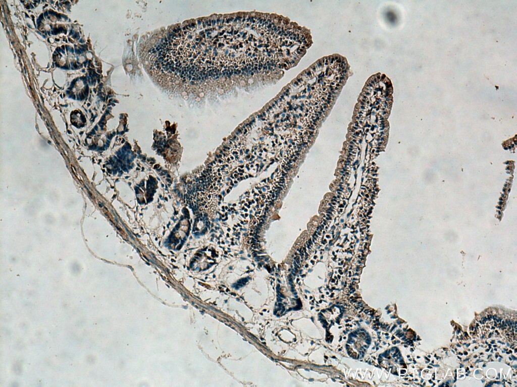 Immunohistochemistry (IHC) staining of mouse small intestine tissue using UPP1 Polyclonal antibody (14186-1-AP)