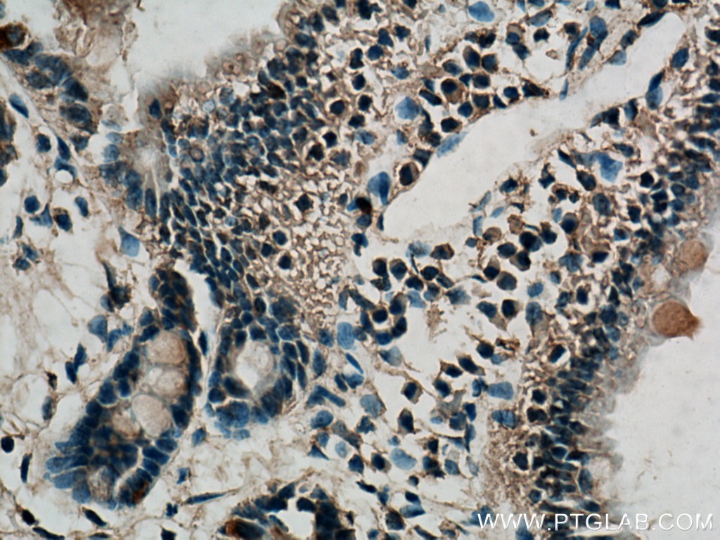 Immunohistochemistry (IHC) staining of mouse small intestine tissue using UPP1 Polyclonal antibody (14186-1-AP)