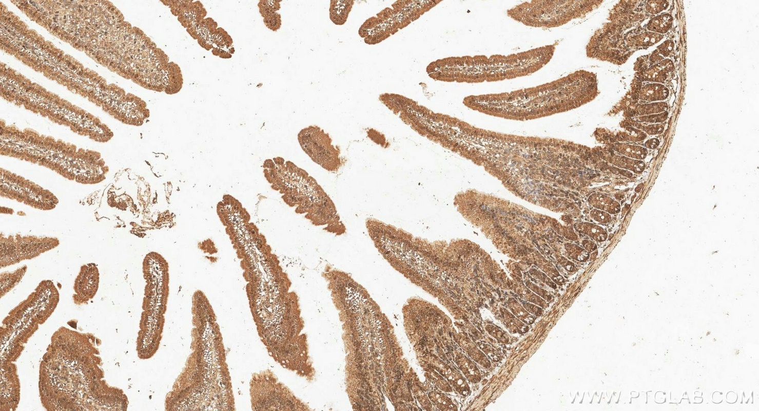 IHC staining of mouse small intestine using 14186-1-AP Immunohistochemistry (IHC) staining of mouse small intestine tissue using UPP1 Polyclonal antibody (14186-1-AP)