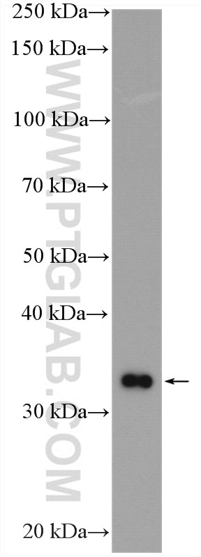 Western Blot (WB) analysis of SGC-7901 cells using UPP1 Polyclonal antibody (14186-1-AP)