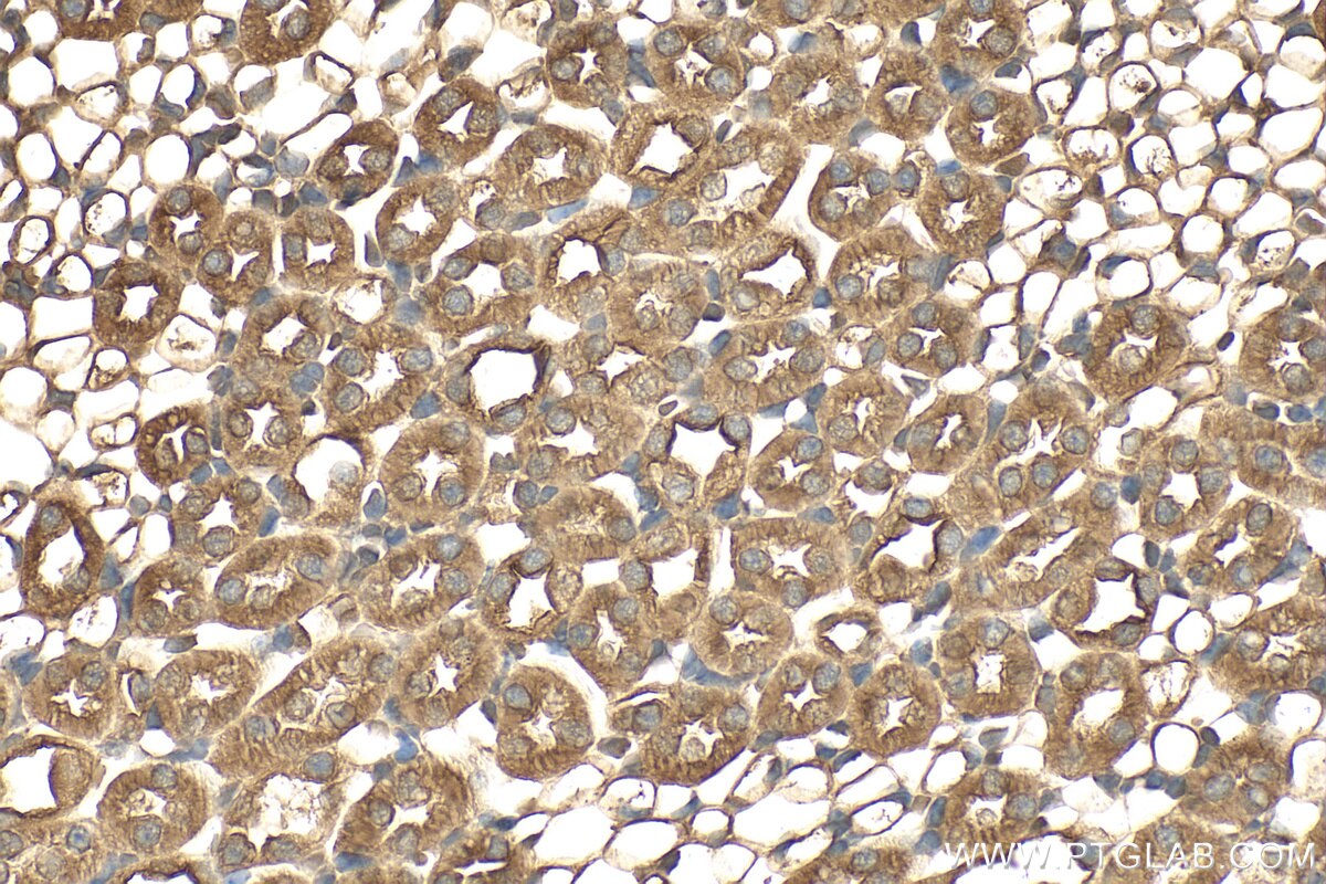 IHC staining of mouse kidney using 12964-1-AP Immunohistochemistry (IHC) staining of mouse kidney tissue using UPP2 Polyclonal antibody (12964-1-AP)