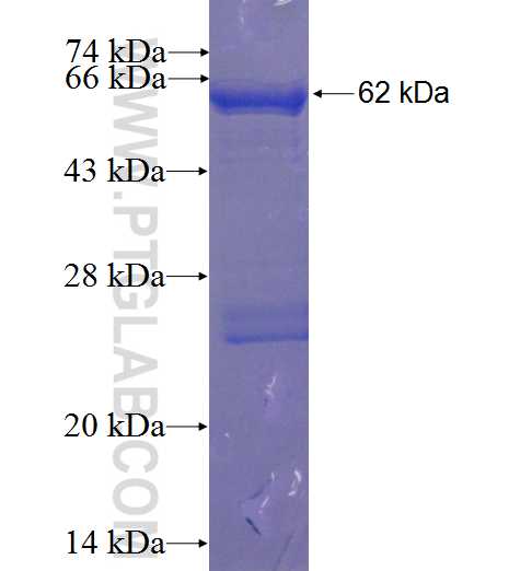 UPP2 fusion protein Ag3619 SDS-PAGE