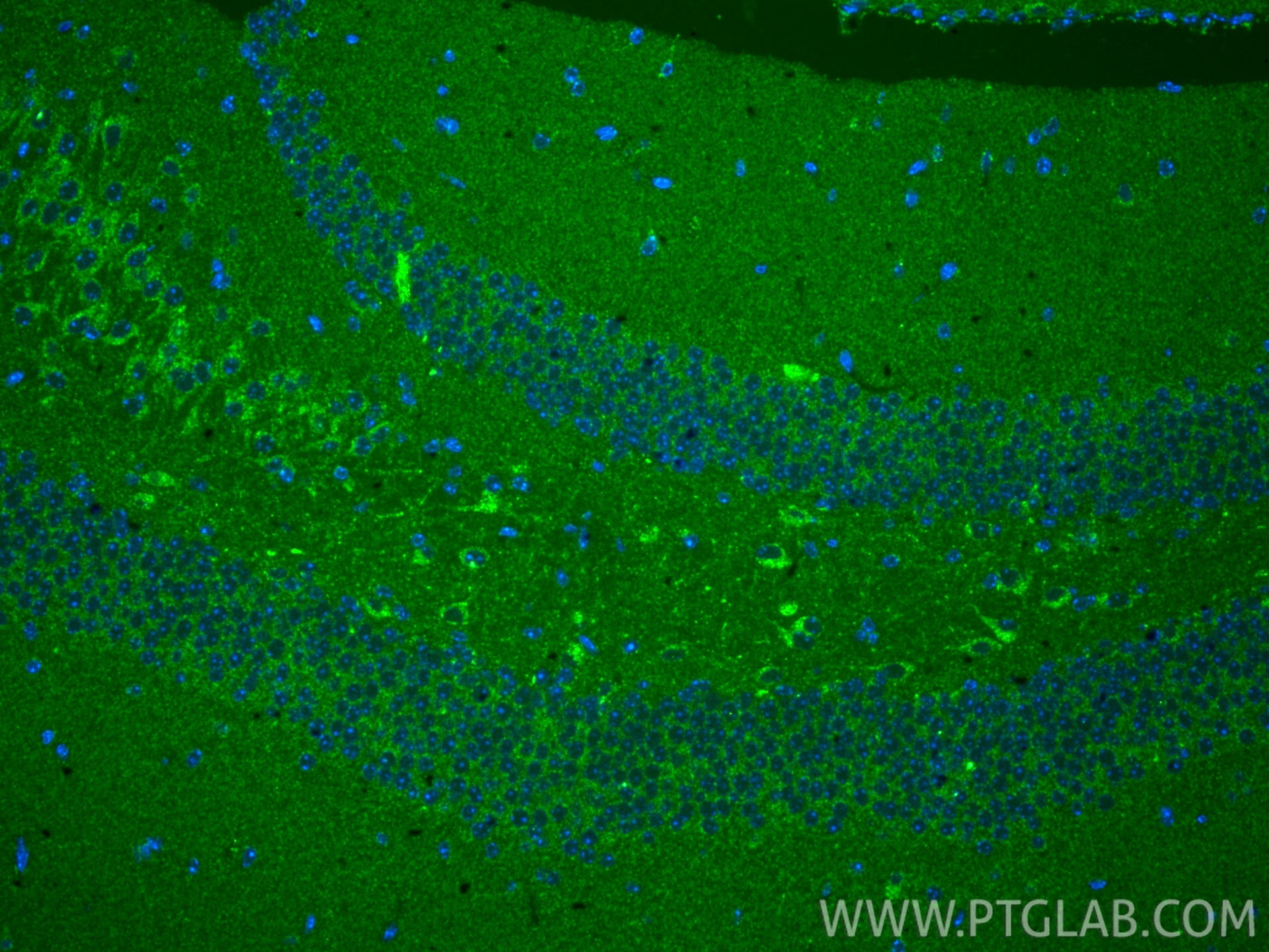 Immunofluorescence (IF) / fluorescent staining of mouse brain tissue using UQCC Polyclonal antibody (28114-1-AP)