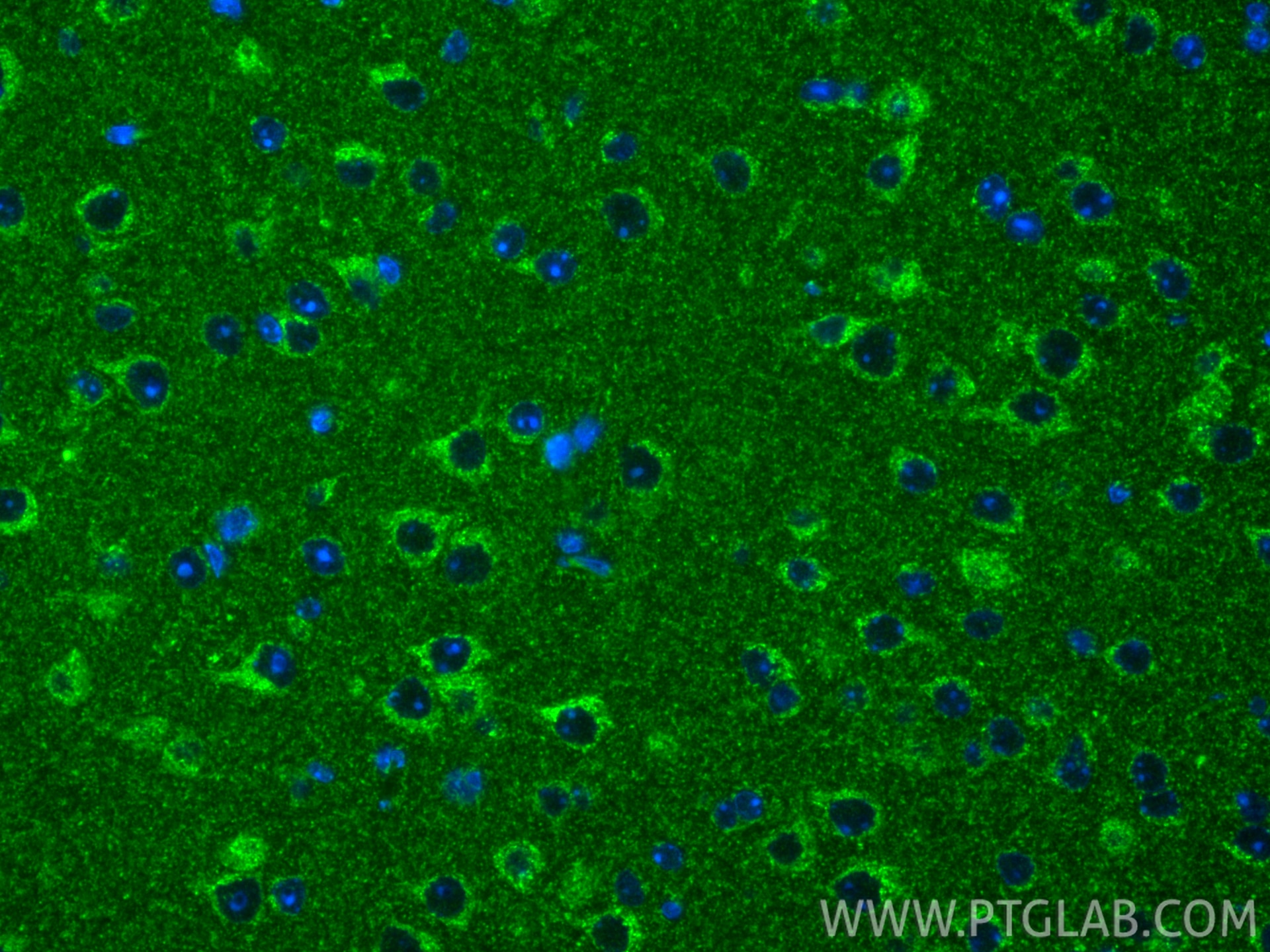 Immunofluorescence (IF) / fluorescent staining of mouse brain tissue using UQCC Polyclonal antibody (28114-1-AP)