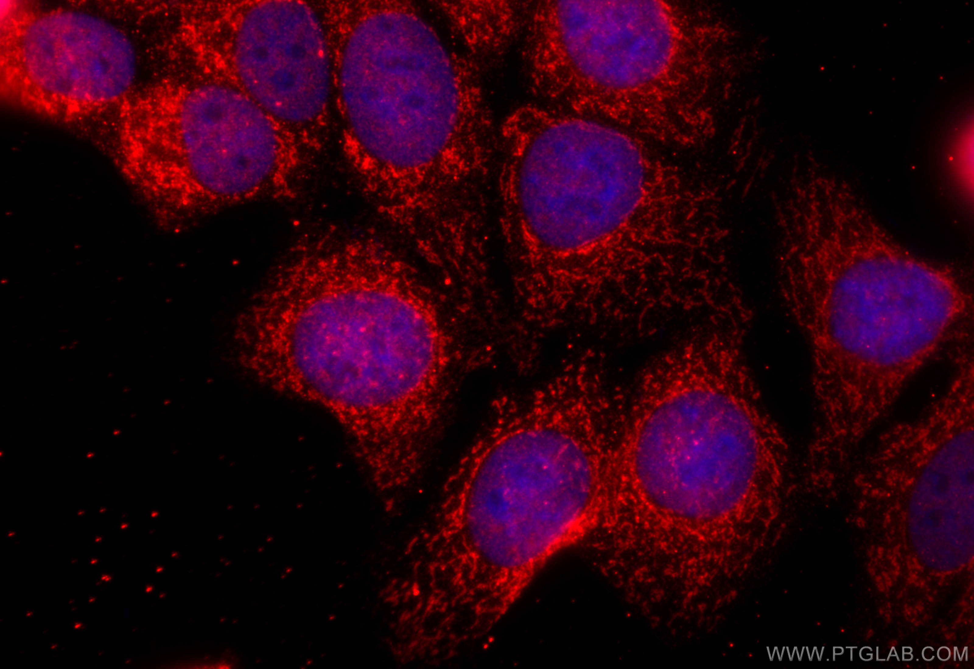 Immunofluorescence (IF) / fluorescent staining of MCF-7 cells using UQCC2 Polyclonal antibody (25781-1-AP)