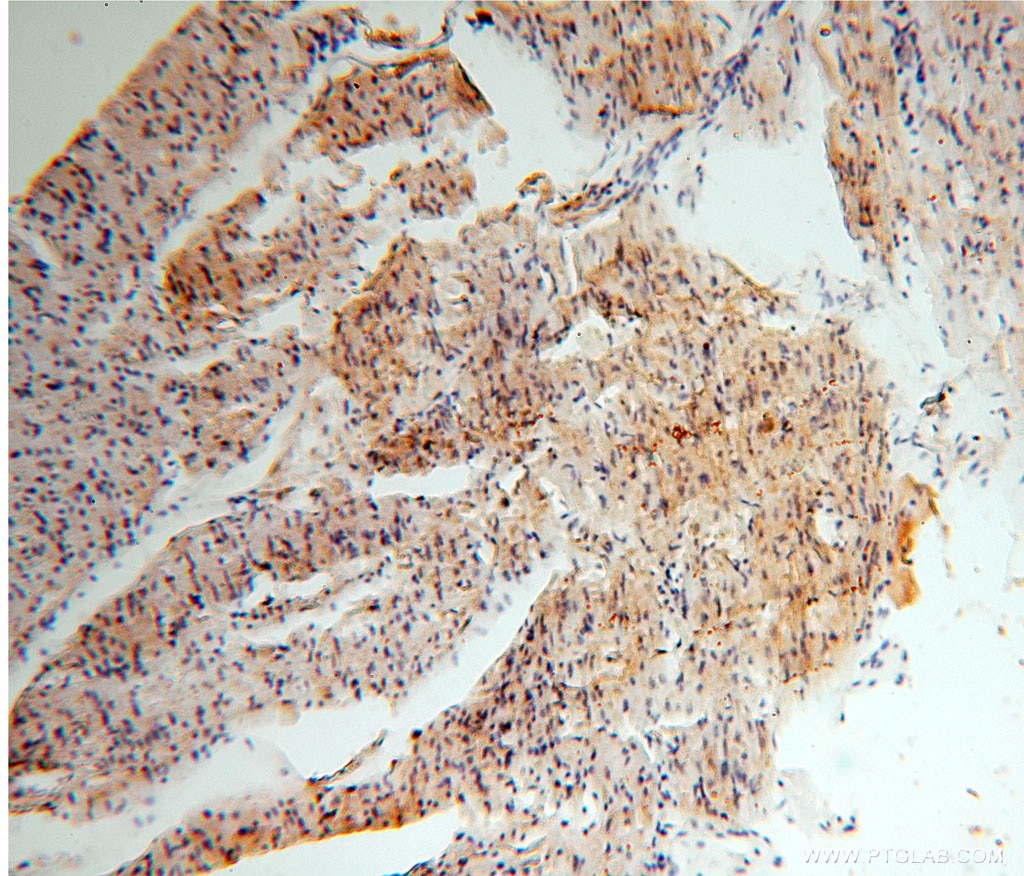 Immunohistochemistry (IHC) staining of human heart tissue using UQCR Polyclonal antibody (14793-1-AP)