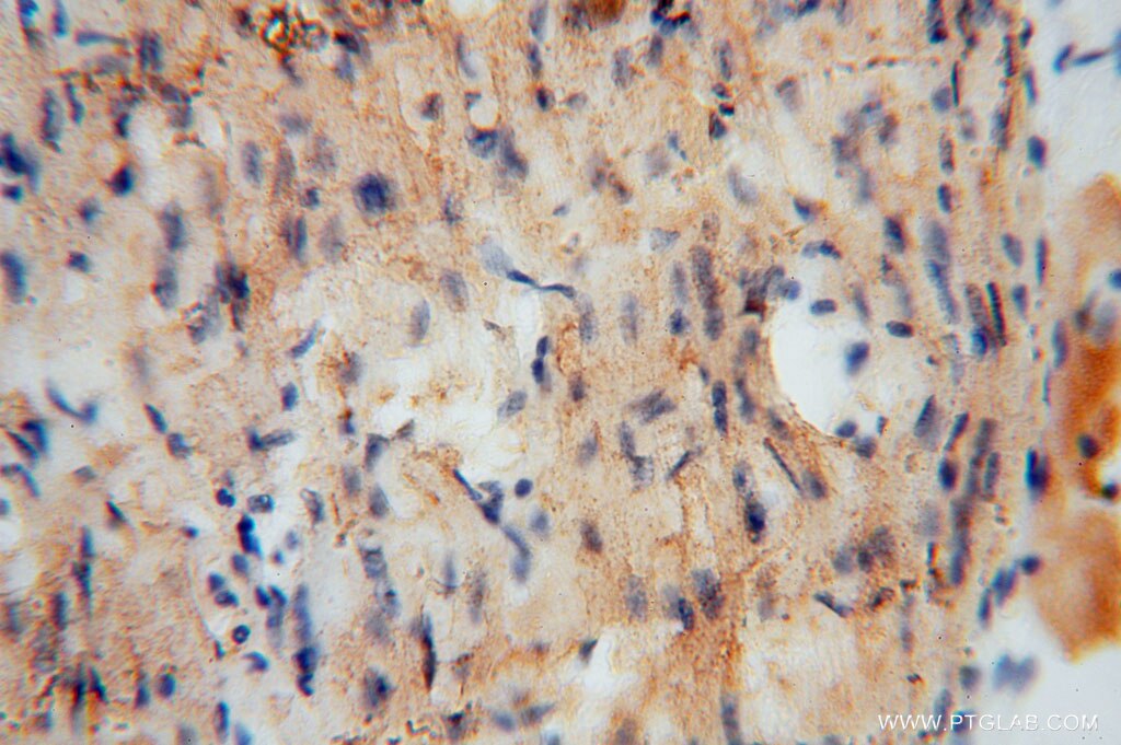 Immunohistochemistry (IHC) staining of human heart tissue using UQCR Polyclonal antibody (14793-1-AP)