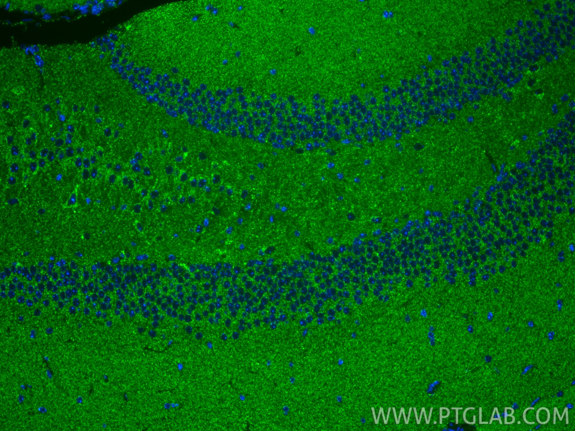 Immunofluorescence (IF) / fluorescent staining of mouse brain tissue using UQCRB Polyclonal antibody (10756-1-AP)