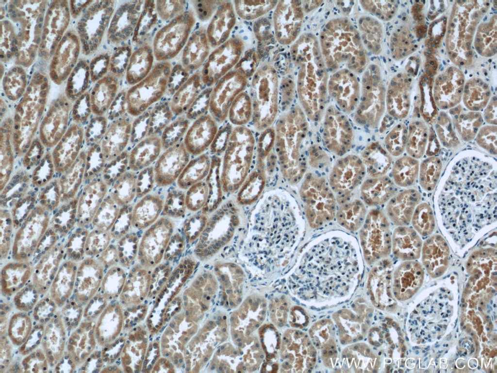 Immunohistochemistry (IHC) staining of human kidney tissue using UQCRB Polyclonal antibody (10756-1-AP)