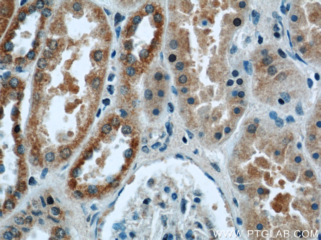 Immunohistochemistry (IHC) staining of human kidney tissue using UQCRB Polyclonal antibody (10756-1-AP)