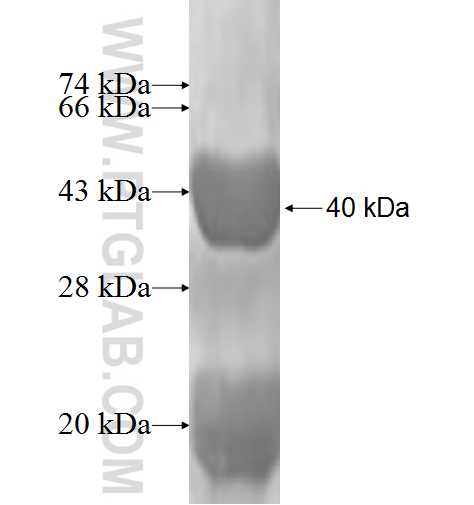 UQCRB fusion protein Ag1127 SDS-PAGE