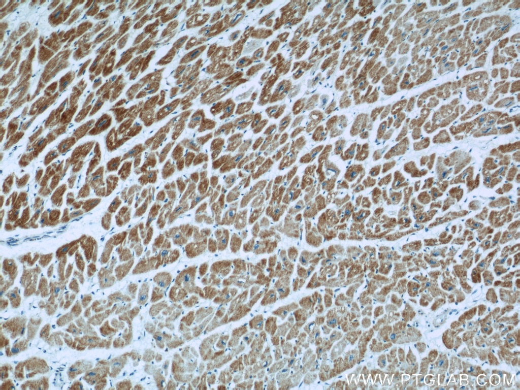 Immunohistochemistry (IHC) staining of human heart tissue using UQCRC1 Polyclonal antibody (21705-1-AP)