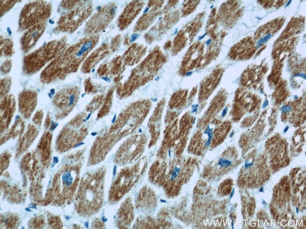 Immunohistochemistry (IHC) staining of human heart tissue using UQCRC1 Polyclonal antibody (21705-1-AP)