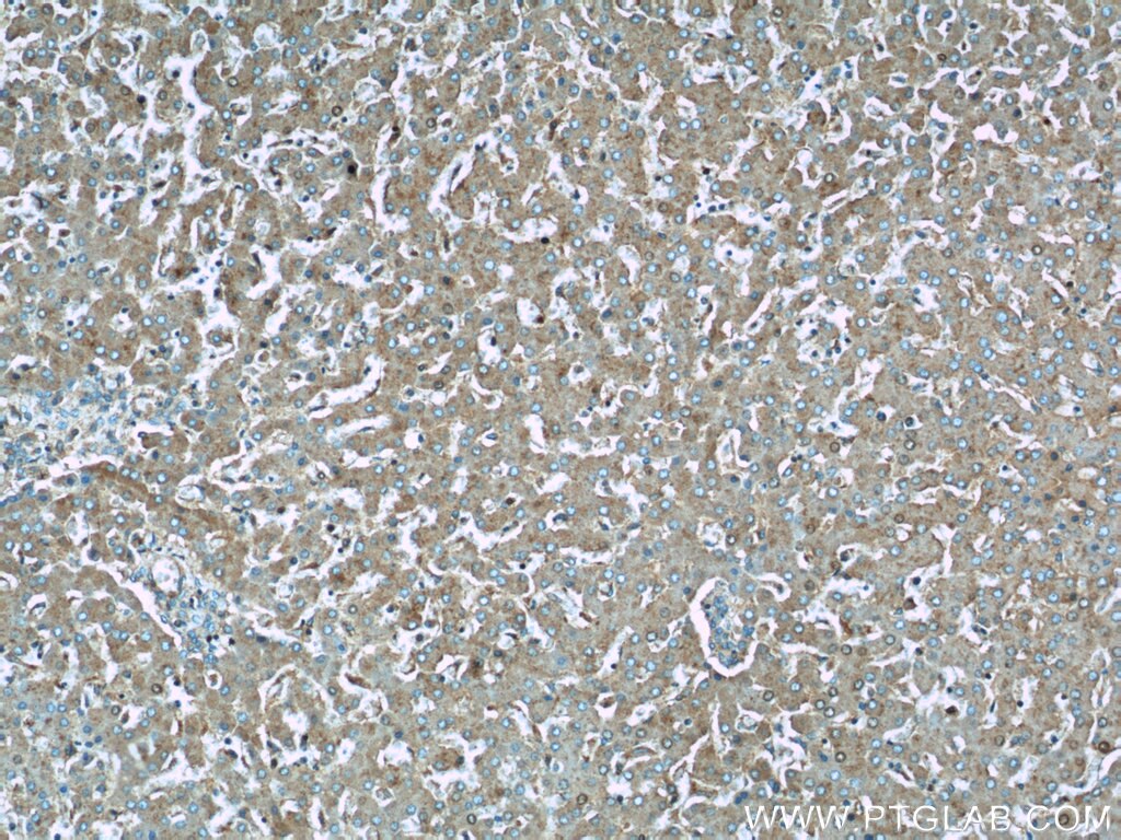 Immunohistochemistry (IHC) staining of human liver tissue using UQCRC1 Polyclonal antibody (21705-1-AP)