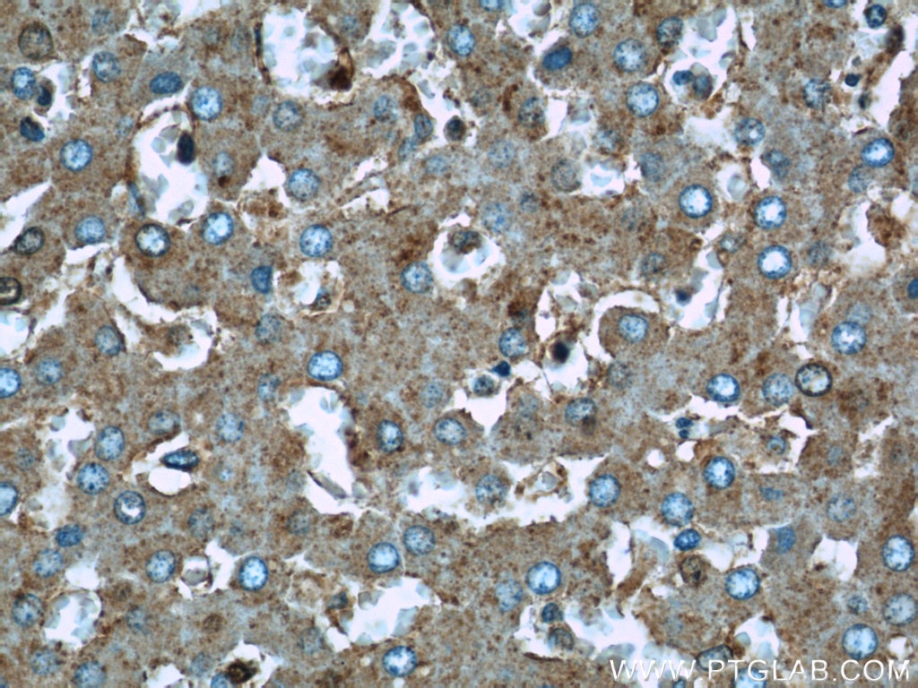 Immunohistochemistry (IHC) staining of human liver tissue using UQCRC1 Polyclonal antibody (21705-1-AP)