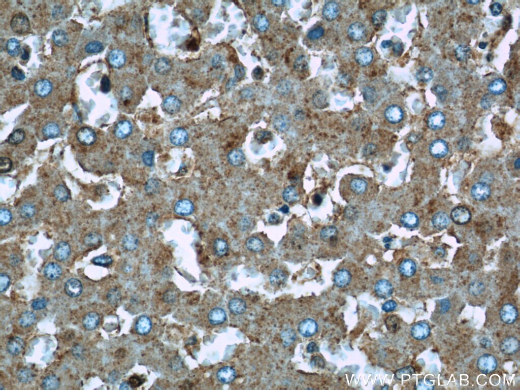 Immunohistochemistry (IHC) staining of human liver tissue using UQCRC1 Polyclonal antibody (21705-1-AP)