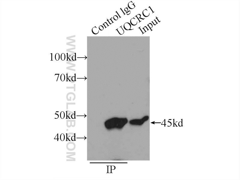 IP experiment of HeLa using 21705-1-AP