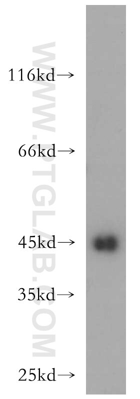 Western Blot (WB) analysis of HeLa cells using UQCRC1 Polyclonal antibody (21705-1-AP)