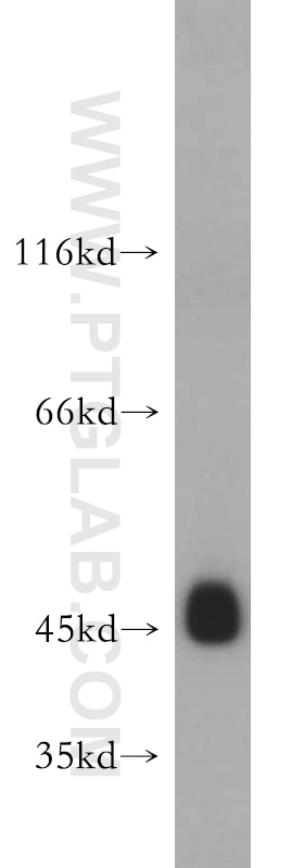 Western Blot (WB) analysis of human skeletal muscle tissue using UQCRC1 Polyclonal antibody (21705-1-AP)