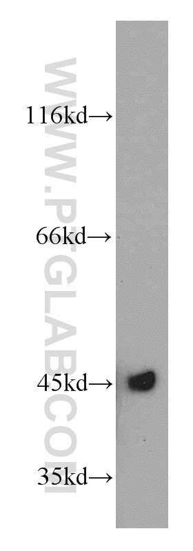 Western Blot (WB) analysis of HeLa cells using UQCRC1 Polyclonal antibody (21705-1-AP)