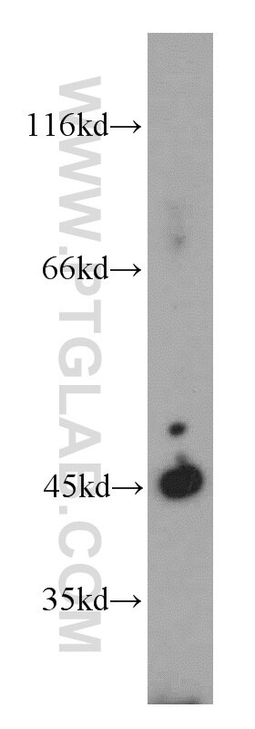 Western Blot (WB) analysis of mouse large intestine tissue using UQCRC1 Polyclonal antibody (21705-1-AP)