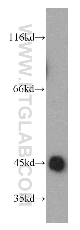 Western Blot (WB) analysis of mouse kidney tissue using UQCRC1 Polyclonal antibody (21705-1-AP)