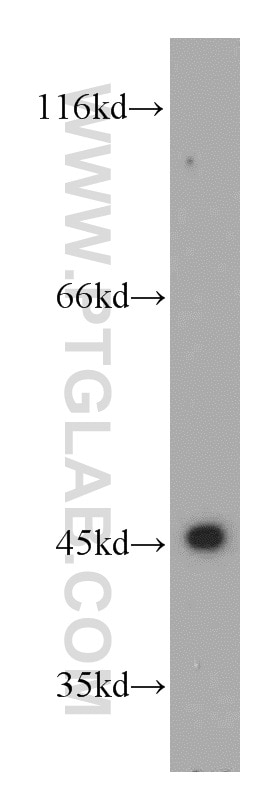 WB analysis of mouse spleen using 21705-1-AP