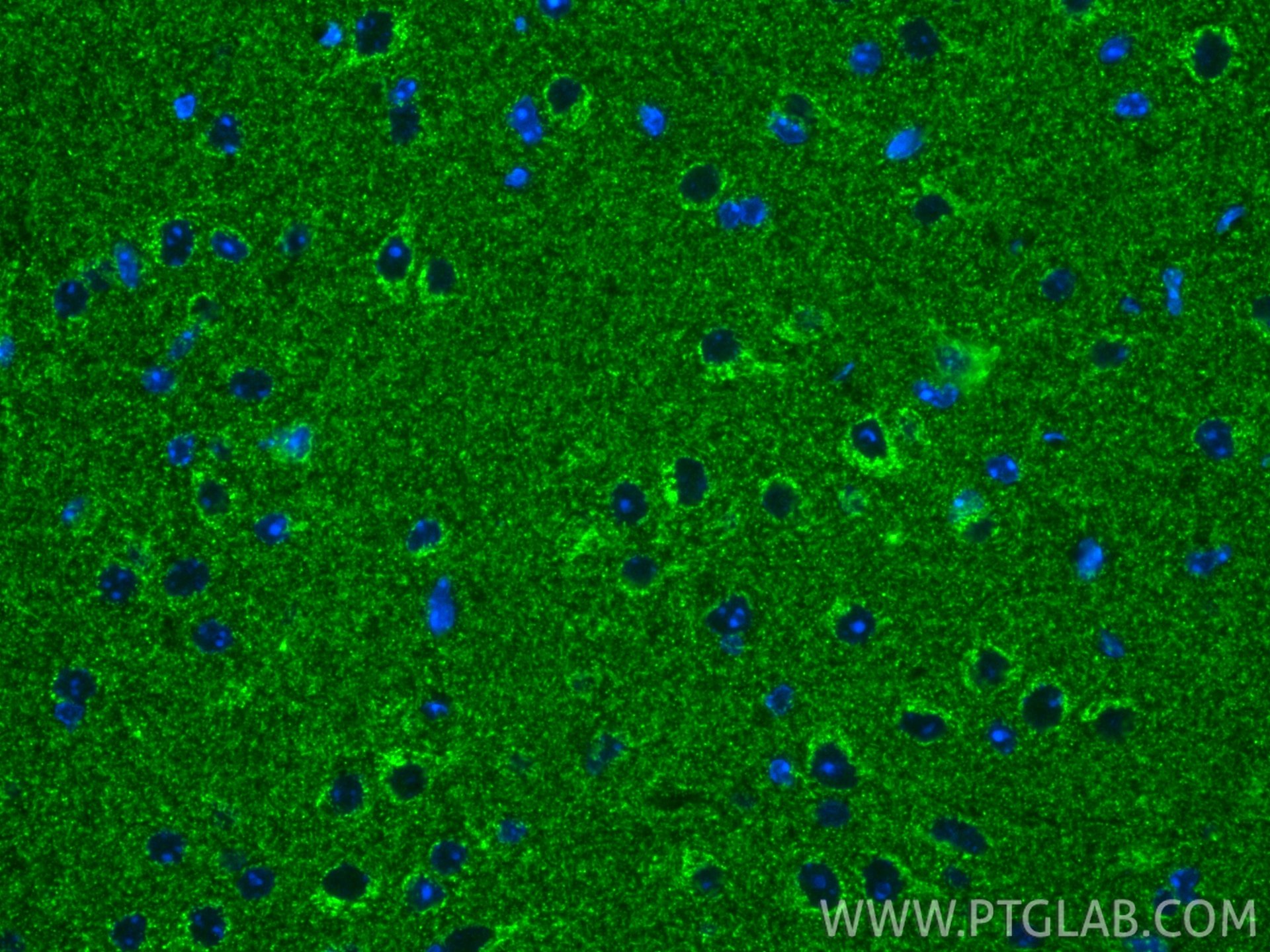 IF Staining of mouse brain using 67888-1-Ig Immunofluorescence (IF) / fluorescent staining of mouse brain tissue using UQCRC1 Monoclonal antibody (67888-1-Ig)