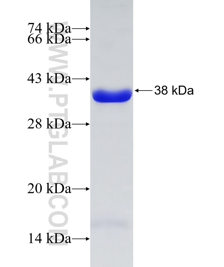 UQCRC1 fusion protein Ag17506 SDS-PAGE