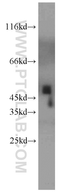 Western Blot (WB) analysis of mouse heart tissue using UQCRC2 Polyclonal antibody (14742-1-AP)