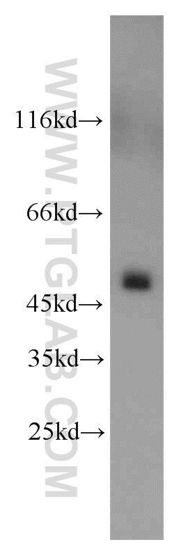 Western Blot (WB) analysis of mouse skeletal muscle tissue using UQCRC2 Polyclonal antibody (14742-1-AP)