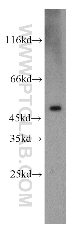 Western Blot (WB) analysis of SGC-7901 cells using UQCRC2 Polyclonal antibody (14742-1-AP)