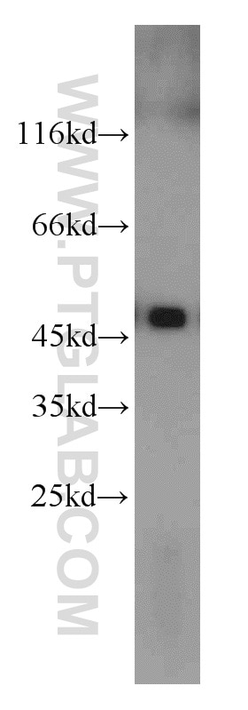 Western Blot (WB) analysis of mouse colon tissue using UQCRC2 Polyclonal antibody (14742-1-AP)