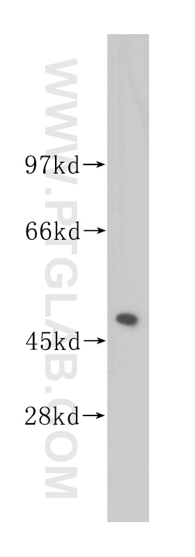 Western Blot (WB) analysis of human colon tissue using UQCRC2 Polyclonal antibody (14742-1-AP)