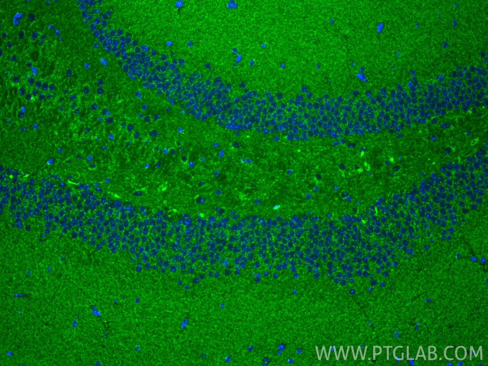 Immunofluorescence (IF) / fluorescent staining of mouse brain tissue using UQCRC2 Monoclonal antibody (67547-1-Ig)