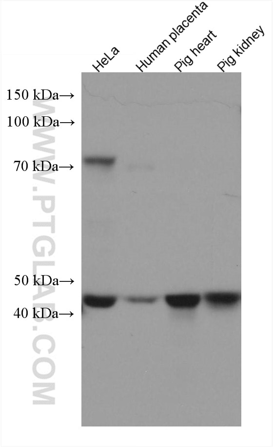 Western Blot (WB) analysis of various lysates using UQCRC2 Monoclonal antibody (67547-1-Ig)