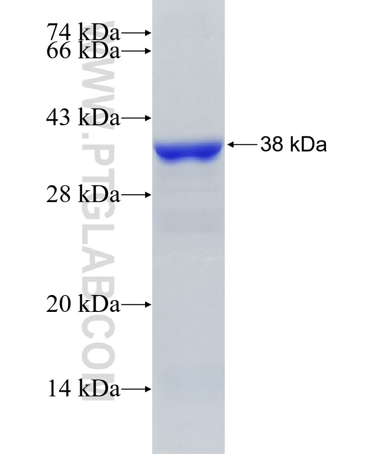 UQCRC2 fusion protein Ag6874 SDS-PAGE