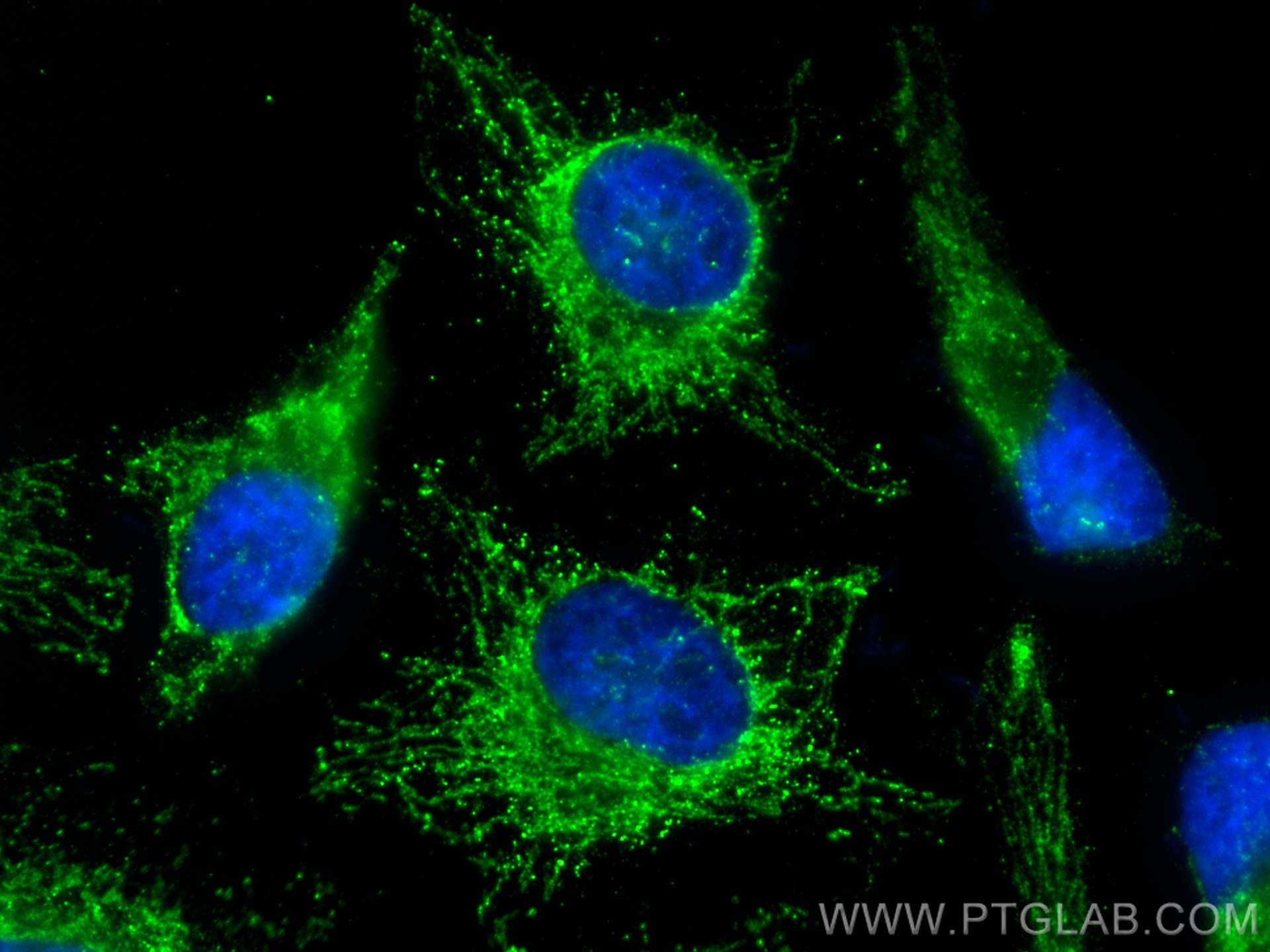 Immunofluorescence (IF) / fluorescent staining of HeLa cells using UQCRFS1 Monoclonal antibody (68529-1-Ig)
