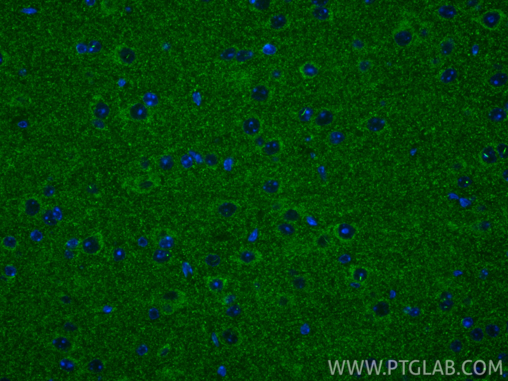 Immunofluorescence (IF) / fluorescent staining of mouse brain tissue using UQCRH Polyclonal antibody (12364-1-AP)