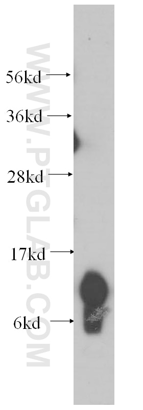 Western Blot (WB) analysis of human liver tissue using UQCRQ Polyclonal antibody (14975-1-AP)