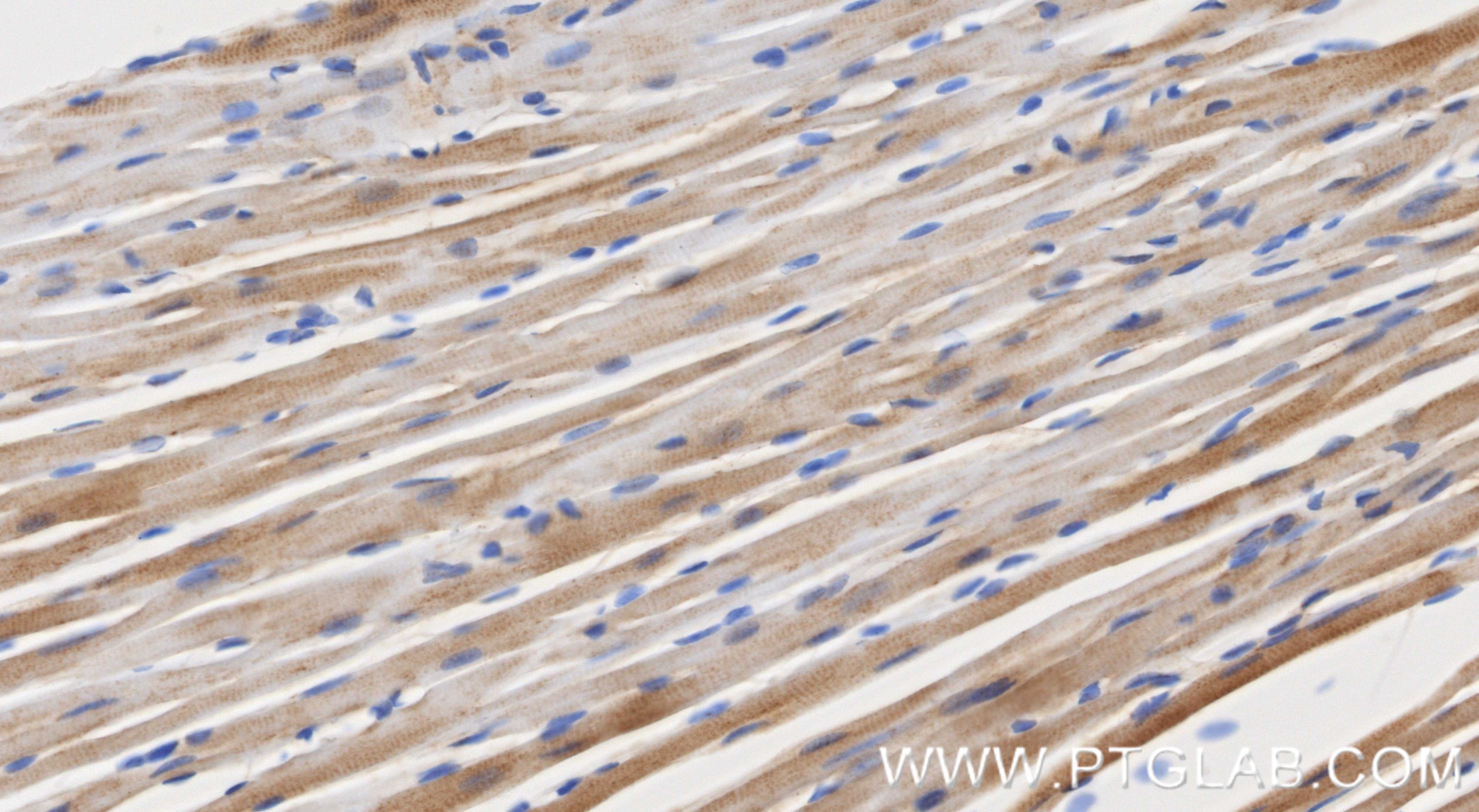 Immunohistochemistry (IHC) staining of mouse heart tissue using UQCRQ Recombinant monoclonal antibody (87199-1-RR)