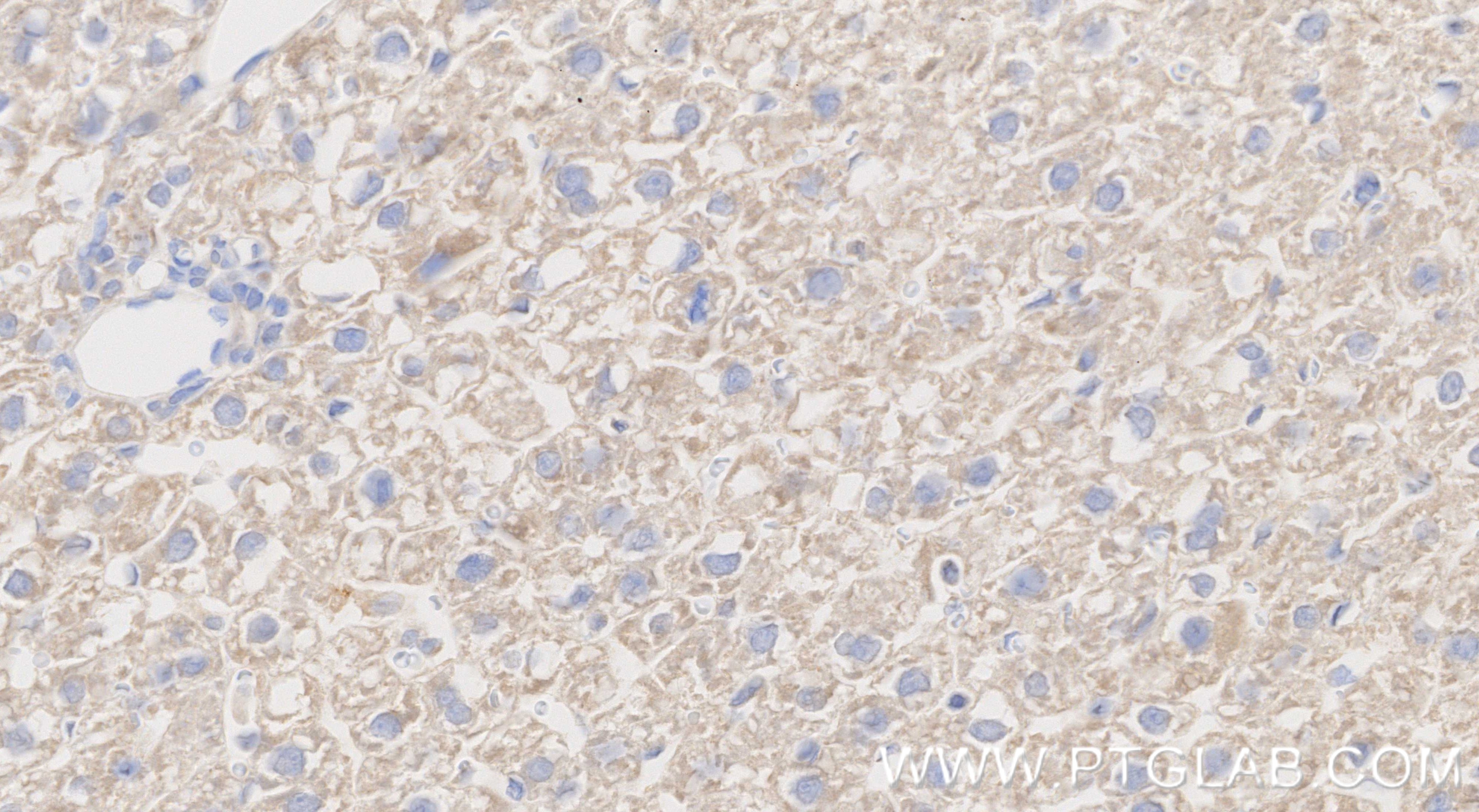Immunohistochemistry (IHC) staining of rat liver tissue using UQCRQ Recombinant monoclonal antibody (87199-1-RR)