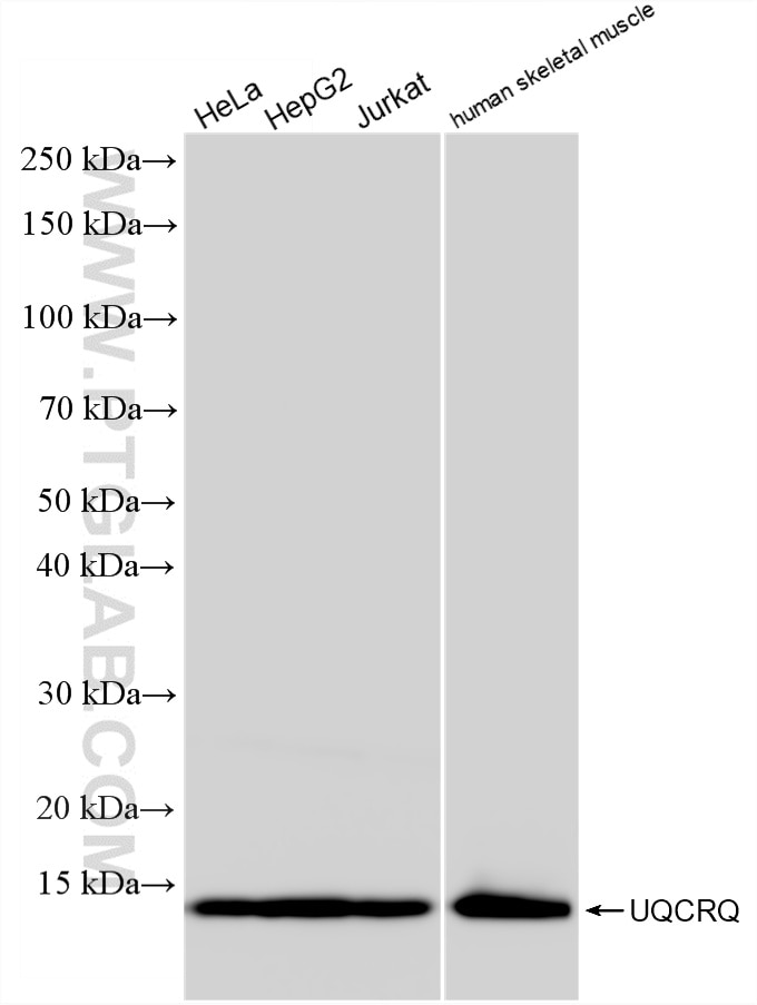 Western Blot (WB) analysis of various lysates using UQCRQ Recombinant monoclonal antibody (87199-1-RR)
