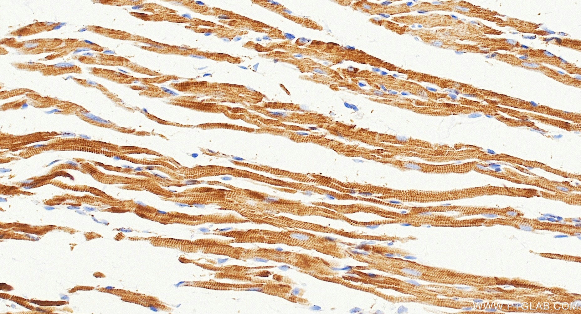 IHC staining of mouse heart using Biotin-87199 Immunohistochemistry (IHC) staining of mouse heart tissue using Biotin-conjugated UQCRQ Recombinant monoclonal ant (Biotin-87199)